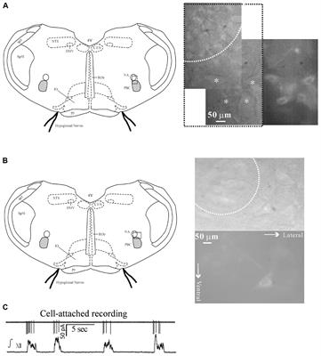 Inspiratory-Activated Airway Vagal Preganglionic Neurones Excited by Thyrotropin-Releasing Hormone via Multiple Mechanisms in Neonatal Rats